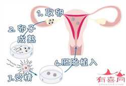 南京供卵中心价格，孕妇感冒头痛应该怎么办？会影响胎儿吗？
